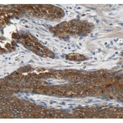 Kallikrein 1-Related Peptidase B3 (KLK1B3) Antibody