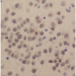 Importin Subunit Alpha-5 (KPNA1) Antibody
