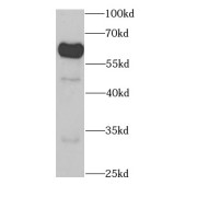 WB analysis of K-562 cells, using KPNA1 antibody (1/1000 dilution).