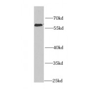 WB analysis of HepG2 cells, using KPNA4 antibody (1/1000 dilution).