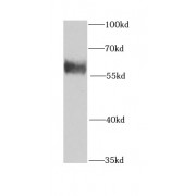 WB analysis of BxPC-3 cells, using KPNA6 antibody (1/1000 dilution).