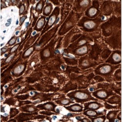 Keratin 33B (KRT33B) Antibody