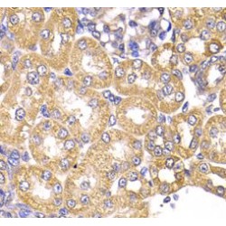 Cytosol Aminopeptidase (LAP3) Antibody