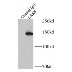 Leucine-tRNA Ligase, Cytoplasmic (LARS) Antibody