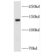 WB analysis of Raji cells, using LARS antibody (1/2000 dilution).
