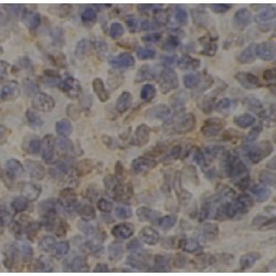 Lymphocyte Transmembrane Adapter 1 (LAX1) Antibody