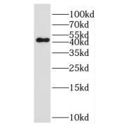WB analysis of HeLa cells, using LAX1 antibody (1/1500 dilution).