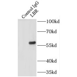 Lamin-B Receptor (LBR) Antibody