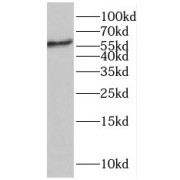 WB analysis of A375 cells, using LBR antibody (1/500 dilution).