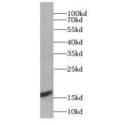 WB analysis of mouse brain tissue, using LC3A-Specific antibody (1/1500 dilution).