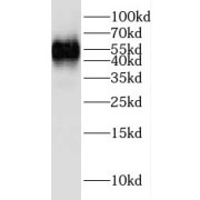 WB analysis of mouse thymus tissue, using LCK antibody (1/1000 dilution).
