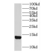 WB analysis of mouse brain tissue, using LDLRAD1 antibody (1/300 dilution).