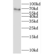 WB analysis of HepG2 cells, using LGALS3BP antibody (1/1000 dilution).