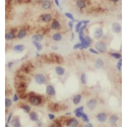 Lectin Galactoside Binding, Soluble 3 Binding Protein (LGALS3BP) Antibody
