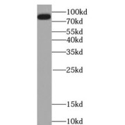 WB analysis of human blood tissue, using LGALS3BP antibody (1/2000 dilution).