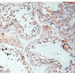Leucine Rich Repeat Containing G Protein-Coupled Receptor 6 (LGR6) Antibody