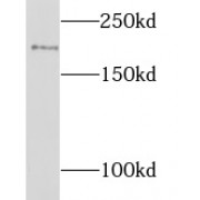WB analysis of human skeletal muscle tissue, using LIFR antibody (1/800 dilution).