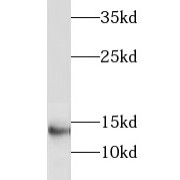WB analysis of Raji cells, using LIMD2 antibody (1/300 dilution).