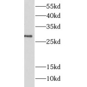 WB analysis of rat brain tissue, using LIN7A antibody (1/1000 dilution).