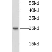 WB analysis of human cerebellum tissue, using LIN7C antibody (1/500 dilution).