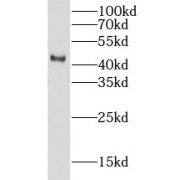 WB analysis of Y79 cells, using LIPA antibody (1/400 dilution).