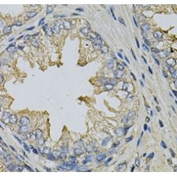 Lipopolysaccharide-Induced Tumor Necrosis Factor-Alpha Factor (LITAF) Antibody