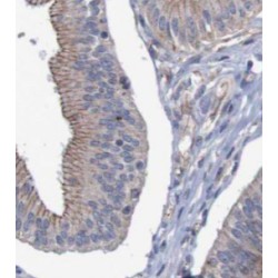 Zinc Transporter ZIP6 (SLC39A6) Antibody