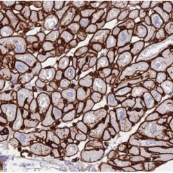 Leucyl-Cystinyl Aminopeptidase (LNPEP) Antibody