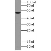WB analysis of HepG2 cells, using LPL antibody (1/1000 dilution).