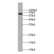WB analysis of Jurkat cells, using LCP1 antibody (1/1000 dilution).