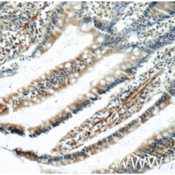 Lipoma-Preferred Partner Homolog (LPP) Antibody