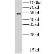 WB analysis of PC-3 cells, using LPXN antibody (1/600 dilution).