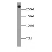 WB analysis of HEK-293 cells, using LRP2-Specific antibody (1/300 dilution).