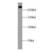 WB analysis of HEK-293 cells, using LRP2-Specific antibody (1/300 dilution).