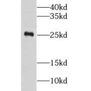 WB analysis of NIH/3T3 cells, using LRRC20 antibody (1/600 dilution).