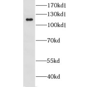 abx234862