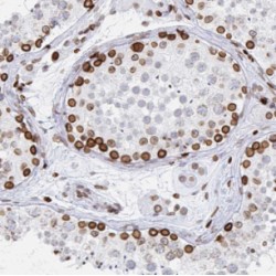 Leucine Rich Repeat Transmembrane Neuronal 1 (LRRTM1) Antibody