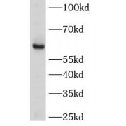 WB analysis of mouse spinal cord tissue, using LRRTM2 antibody (1/600 dilution).