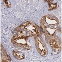 LSM1 Homolog, mRNA Degradation Associated (LSM1) Antibody