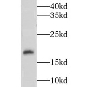 WB analysis of HeLa cells, using LSM1 antibody (1/600 dilution).