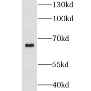 WB analysis of HepG2 cells, using LSM14A antibody (1/500 dilution).