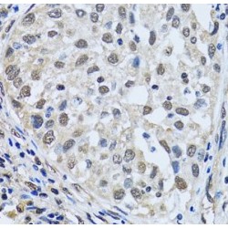 LSM4 Homolog, U6 Small Nuclear RNA And mRNA Degradation Associated (LSM4) Antibody