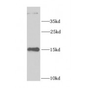WB analysis of MCF7 cells, using LSM4 antibody (1/1000 dilution).