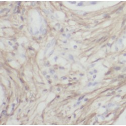 Latent Transforming Growth Factor Beta Binding Protein 1 (LTBP1) Antibody