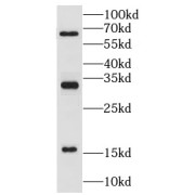 WB analysis of mouse spleen tissue, using LY6G5C antibody (1/1000 dilution).