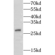 WB analysis of human testis tissue, using LY6K antibody (1/500 dilution).