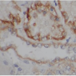 Lymphocyte Antigen 96 (LY96) Antibody