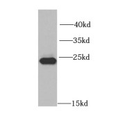 WB analysis of HeLa cells, using MAD2L2 antibody (1/1000 dilution).