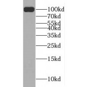 WB analysis of mouse spinal cord tissue, using MAG antibody (1/2500 dilution).