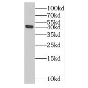 WB analysis of Jurkat cells, using MAGEA10 antibody (1/500 dilution).